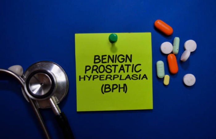 Benign prostatic hyperplasia