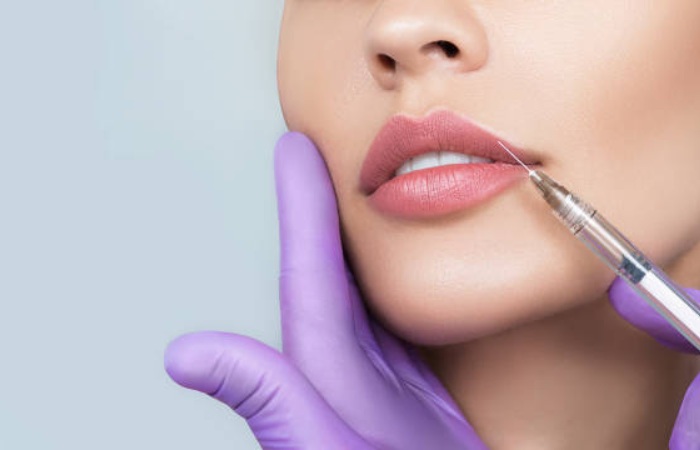 What Can Lip Fillers Do For You